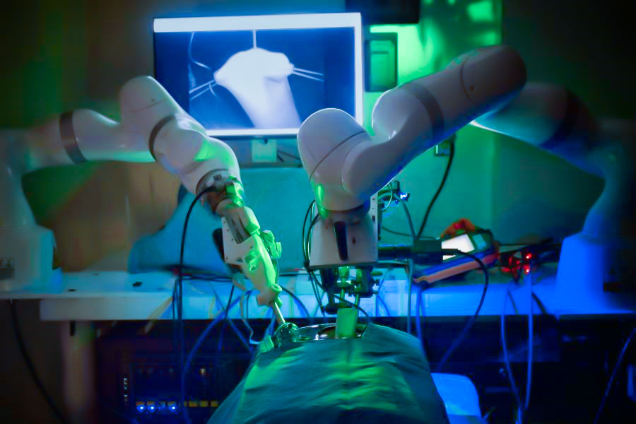 Carbon fiber reinforced plastic titanium joints in surgical robots